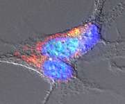 Imagen microscópica de neuronas tratadas con amiloides bacterianos en las que se detectan agregados de una proteína relacionada con esa enfermedad. Imagen cedida por el CSIC. EFE