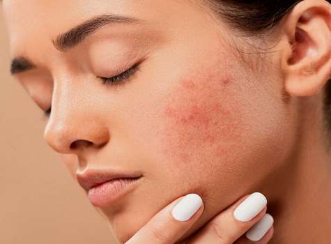 Sabe usted si el maquillaje le causa alguna reacción alérgica? | Critica
