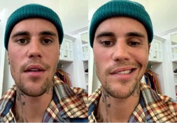 Justin Bieber sufre parálisis facial y cancela sus presentaciones