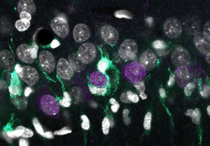 Acumulación desigual de microglía (turquesa) alrededor de las neuronas superficiales de CA1 (en violeta), rodeados por otros núcleos celulares (blanco). EFE