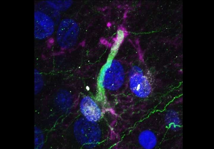 Imagen de una célula madre neural en el hipocampo humano adulto. Imagen: EFE