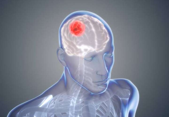 Descubren un mecanismo celular implicado en el tumor cerebral más agresivo