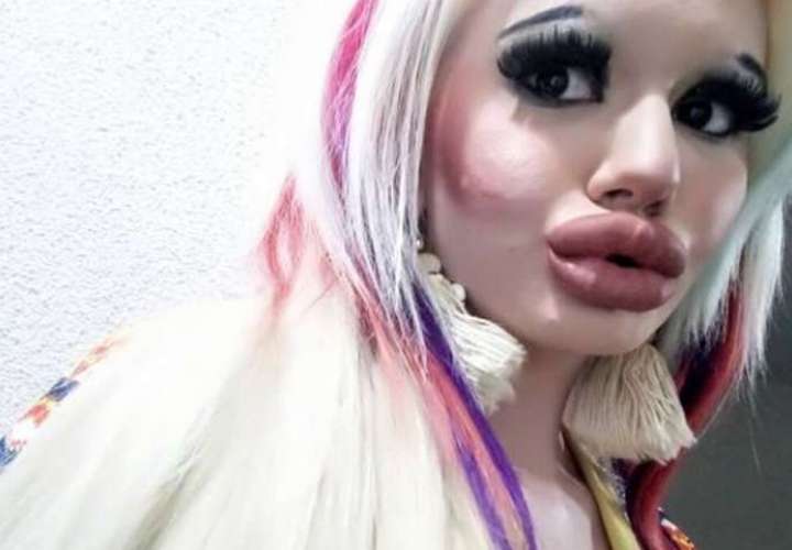 Mujer se deforma el rostro para tener los labios más grandes del mundo (Fotos)