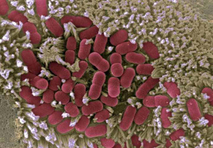 Imagen microscópica de la mucosa intestinal afectada por E.coli. EFE