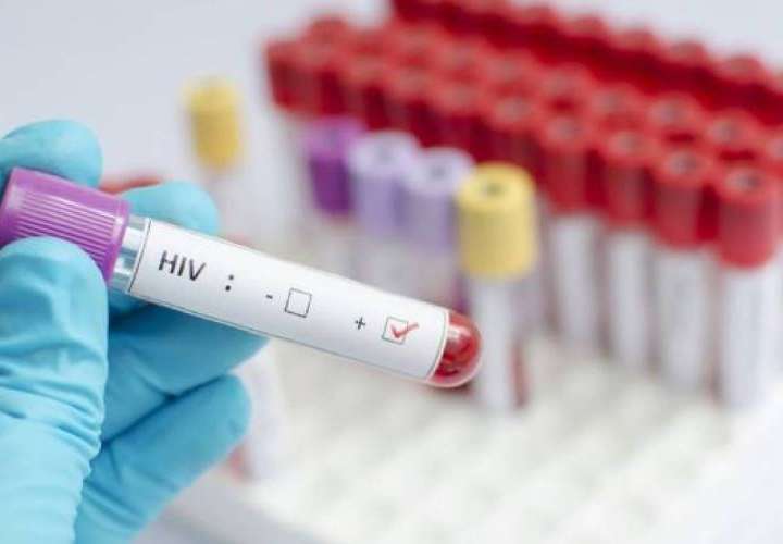 En Panamá 20 mil personas viven con VIH