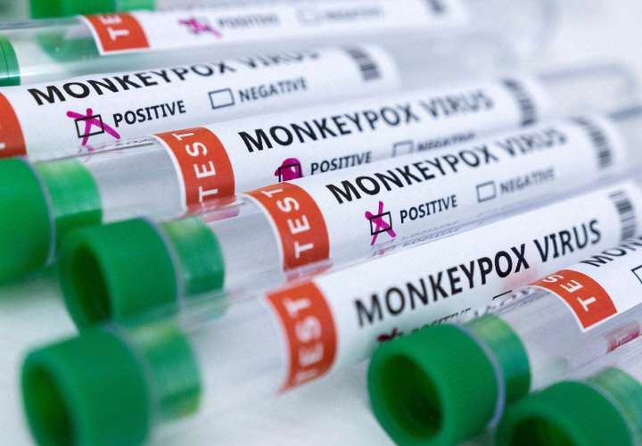 Vienen mil vacunas para la viruela del mono