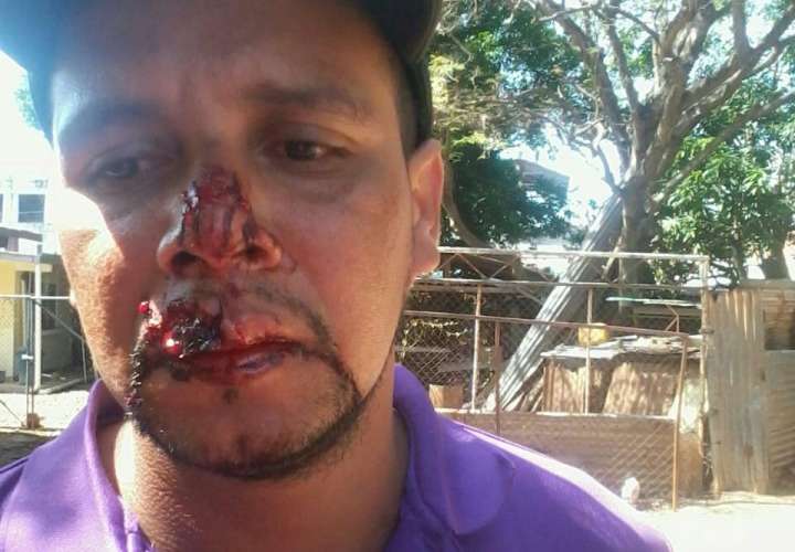 El herido fue sometido a una cirugía en el hospital Gustavo Nelson Collado de Chitré. (Foto: T.Domínguez)