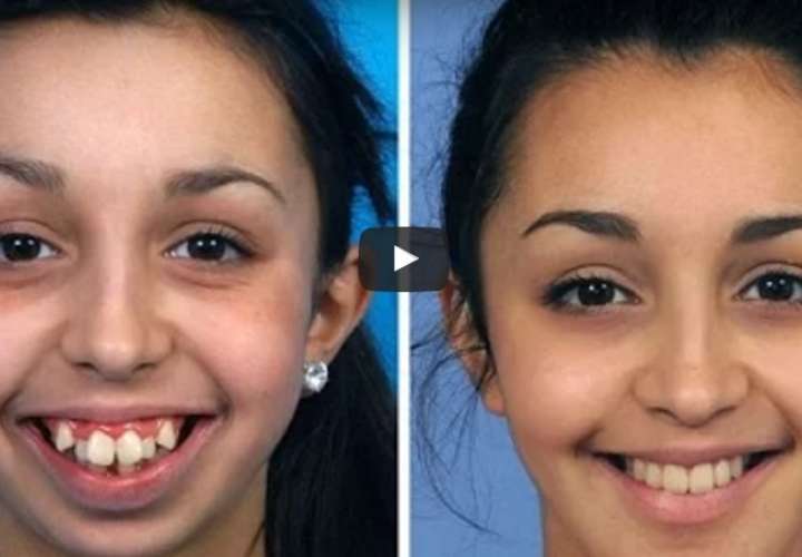 El increíble cambio de joven tras operación de mandíbula