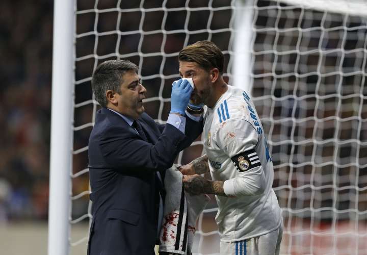El Real confirma fractura de Sergio Ramos