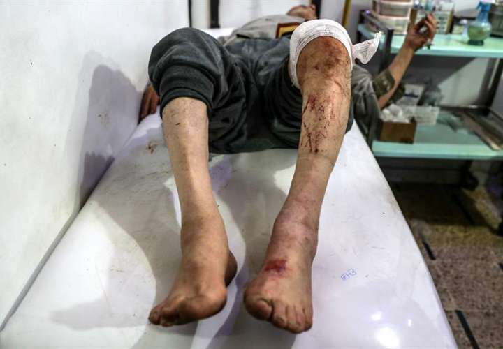 Un herido en un bobardeo es atendido en un hospital de campo de Douma, Siria. EFE