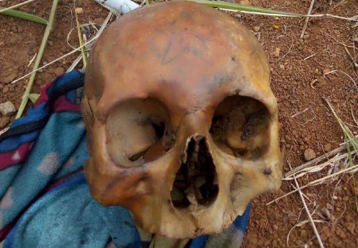 Hallan cráneo en una zanja en Villa del Caribe, de Colón