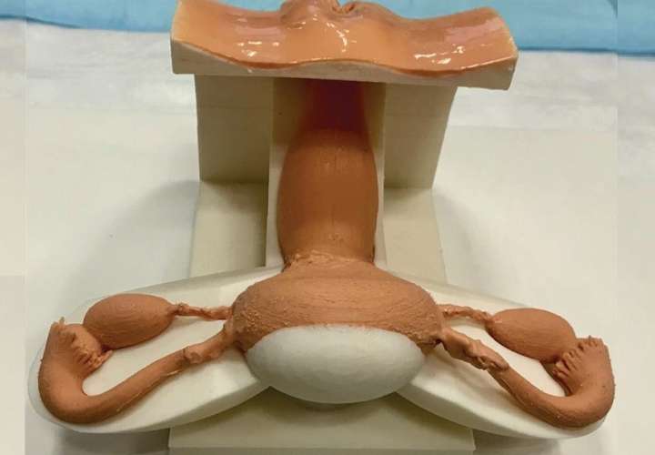Réplica impresa en tres dimensiones (3D) del sistema reproductor femenino que incluye los ovarios, las trompas de Falopio, el útero y el cuello uterino utilizado para entrenar a residentes de hospitales. EFE/Lazarus 3D