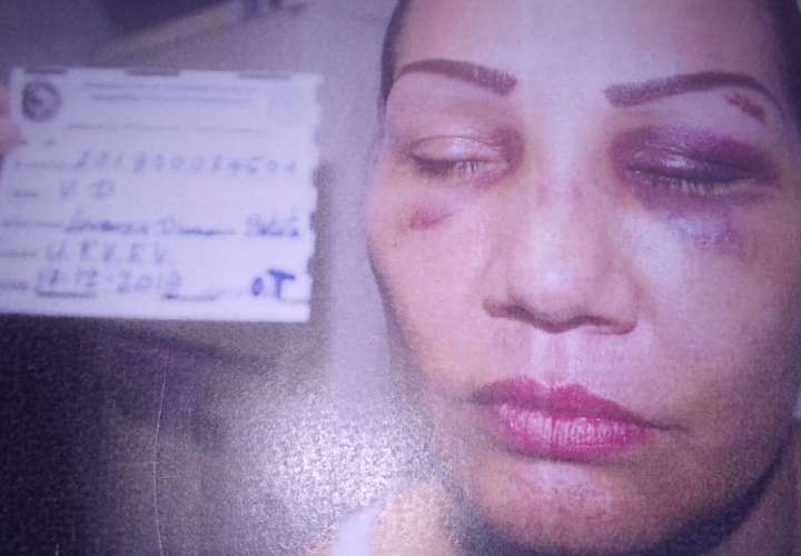 Mujer brutalmente golpeada pasa de ser víctima a victimaria