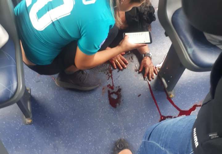 Mujer herida en la cabeza cuando vándalos lanzan piedra a metrobus 