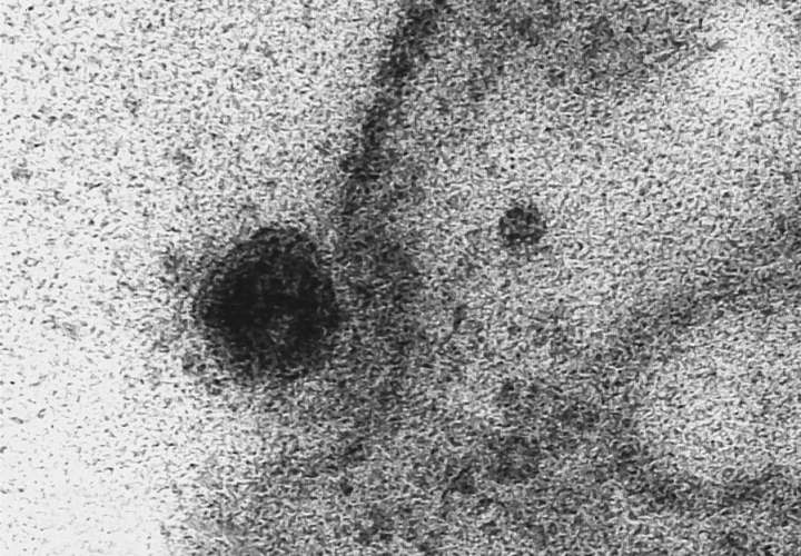 Captan imágenes del momento exacto en que coronavirus infecta una célula