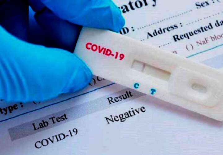 Minsa advierte que pruebas caseras para detectar Covid-19 no están autorizadas 