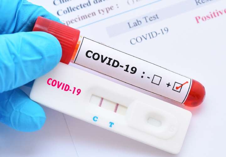 Se reducen los contagios por Covid-19