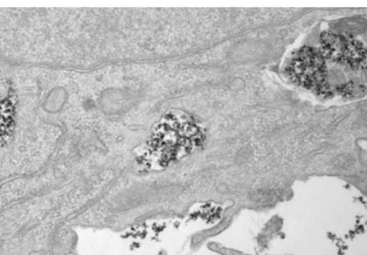 Nanopartículas de óxido de hierro en el interior de vesículas celulares en una imagen tomada con un microscopio electrónico de transmisión (TEM). Yadileiny Portilla/Domingo F Barber, CNB-CSIC. EFE
