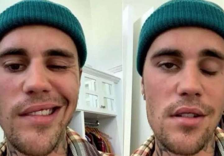 Justin reaparece en los escenarios tras sufrir parálisis facial