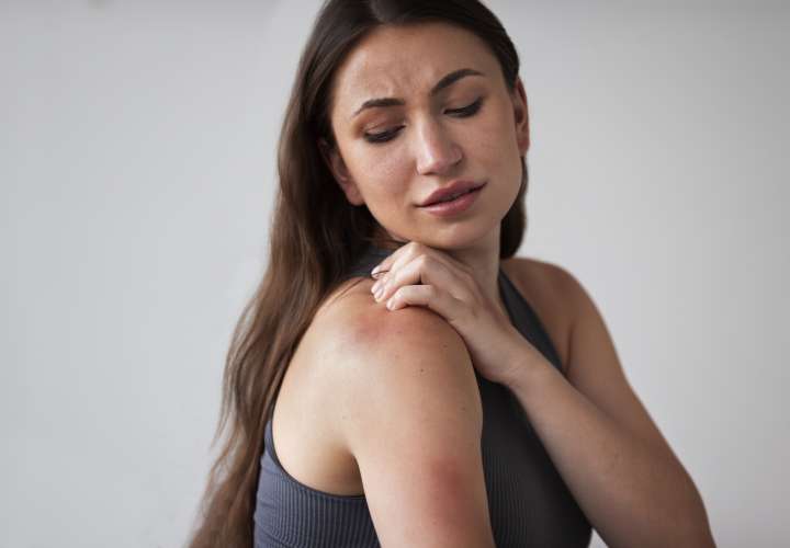 La dermatitis atópica es una enfermedad inflamatoria y crónica de la piel. Foto: Cortesía