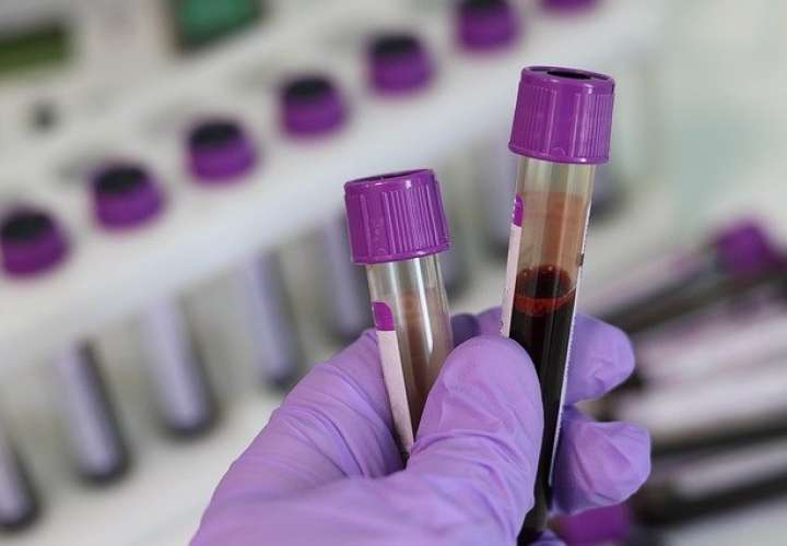 El test detecta los cambios químicos en fragmentos del ADN que se filtran a la sangre a través de los tumores. Foto: Pixabay - Ilustrativa