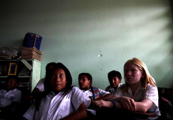 Los gunas, la etnia panameña marcada por el albinismo