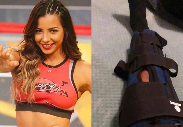 ¡Auch! 'La chama' Stephany Vásquez tuvo una fuerte lesión, ella pensó lo peor