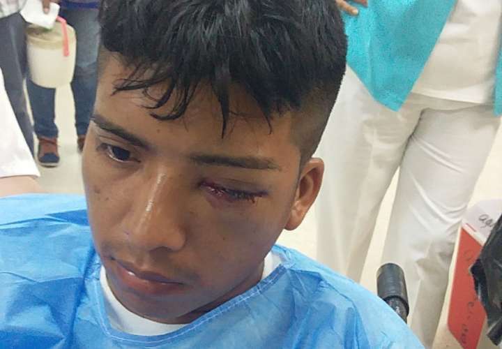Joven indígena pierde el ojo tras manifestaciones en San Juan