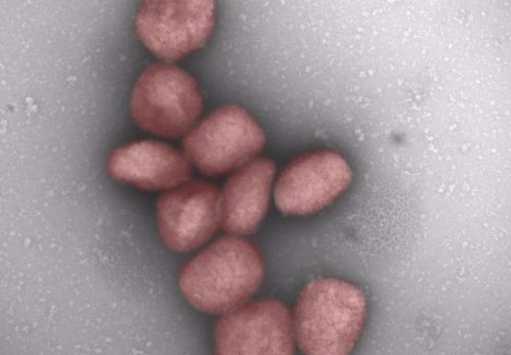 Partículas del virus de la viruela del mono teñidas de rojo en una fotografía facilitada por el Centro de Biología Molecular Severo Ochoa (CBMSO-CSIC-UAM) (Bruno Hernáez). EFE