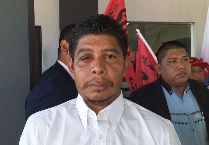 Suntracs pide sanción para unidad policial que agredió a dirigente