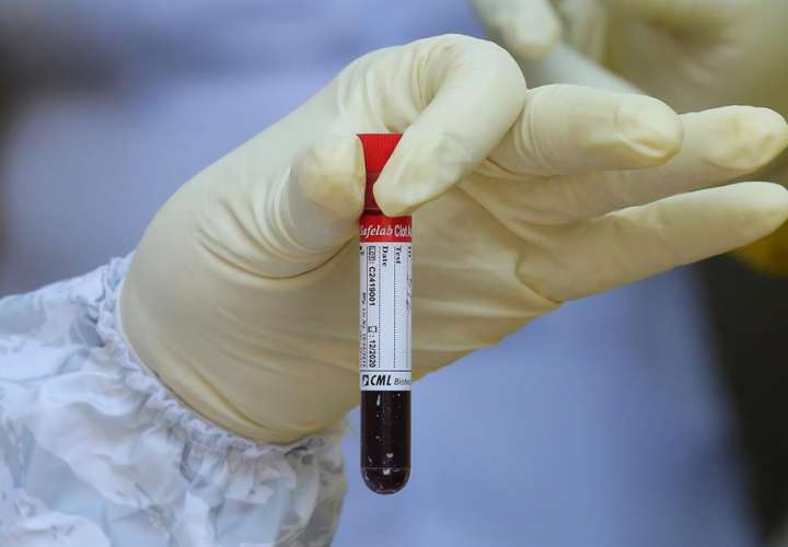 Una de las investigaciones publicadas, se sugiere que las personas con el tipo de sangre O pueden tener un menor riesgo de infección por COVID-19. EFE