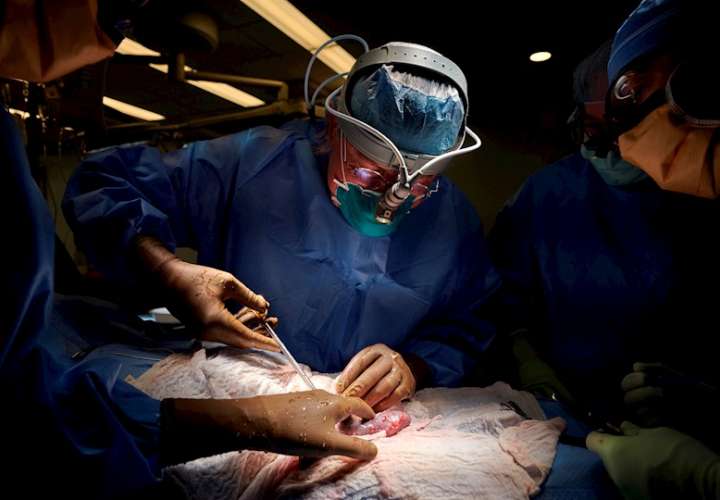 Fotografía cedida este jueves por el hospital NYU Langone Health en la que se registró al equipo quirúrgico, mientras realizan el primer xenotrasplante de un riñón de cerdo modificado genéticamente a un ser humano. EFE