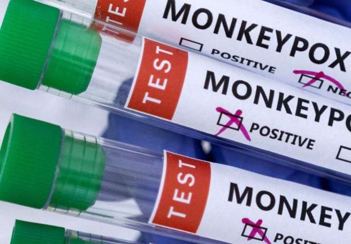 Ya suman 12 los casos del virus del Mono en Panamá 