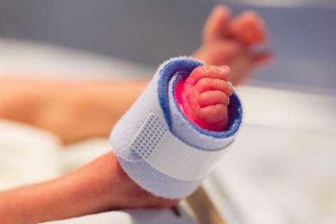 Cada año nacen unos 15 millones de bebés prematuros o pretérmino (antes de la semana 37). Imagen Ilustrativa- Pixabay