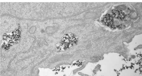 Nanopartículas de óxido de hierro en el interior de vesículas celulares en una imagen tomada con un microscopio electrónico de transmisión (TEM). Yadileiny Portilla/Domingo F Barber, CNB-CSIC. EFE