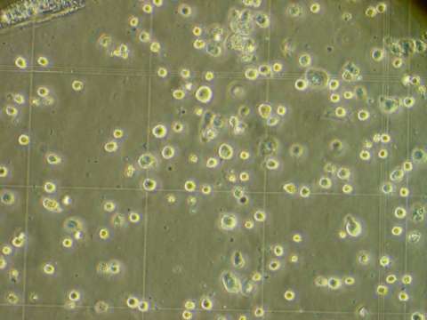 Aspecto de las células madre. EFE / Archivo