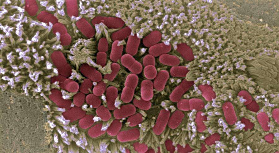 Imagen microscópica de la mucosa intestinal afectada por E.coli. EFE