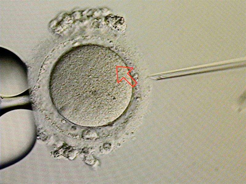 Fotografía fechada el 25 de mayo de 2018, muestra un análisis de óvulos en microscopio, en el IVF Centro de Reproducción, en Ciudad de Panamá (Panamá). EFE