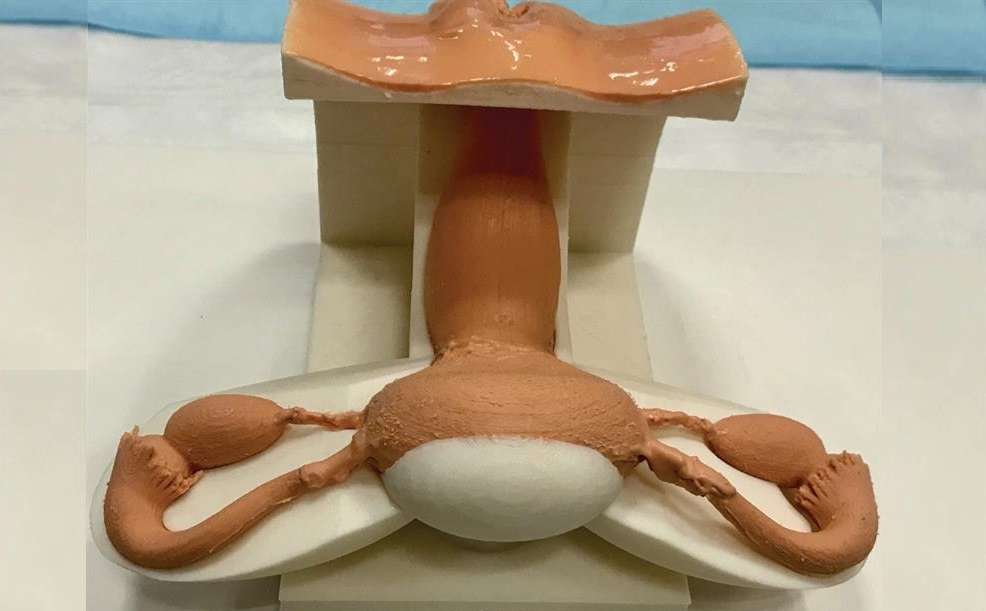 Réplica impresa en tres dimensiones (3D) del sistema reproductor femenino que incluye los ovarios, las trompas de Falopio, el útero y el cuello uterino utilizado para entrenar a residentes de hospitales. EFE/Lazarus 3D