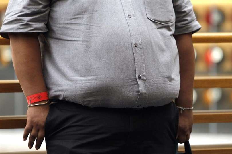 Fotografía muestra una persona con obesidad en una calle en la Ciudad de México (México). EF