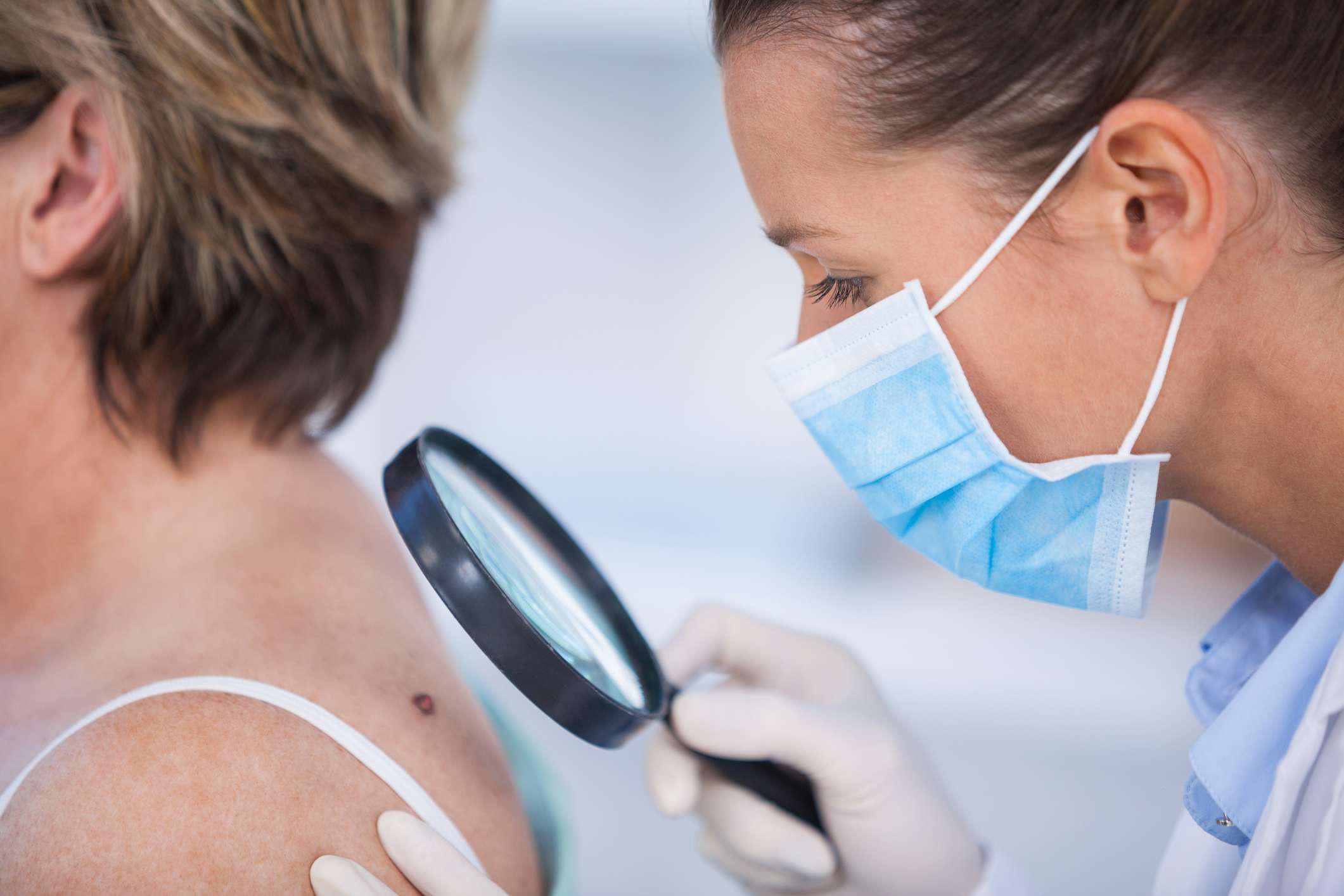El riesgo de padecer un melanoma acrecienta en individuos menores de 40 años, especialmente en las mujeres. Foto: Cortesía