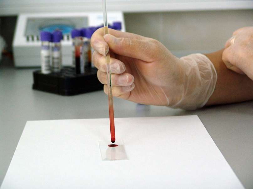 Esta investigación, orientada a encontrar biomarcadores en sangre que permitan hacer el diagnóstico de forma menos invasiva. Imagen ilustrativa / Pixabay