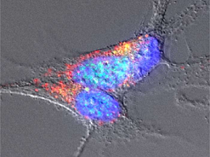 Imagen microscópica de neuronas tratadas con amiloides bacterianos en las que se detectan agregados de una proteína relacionada con esa enfermedad. Imagen cedida por el CSIC. EFE