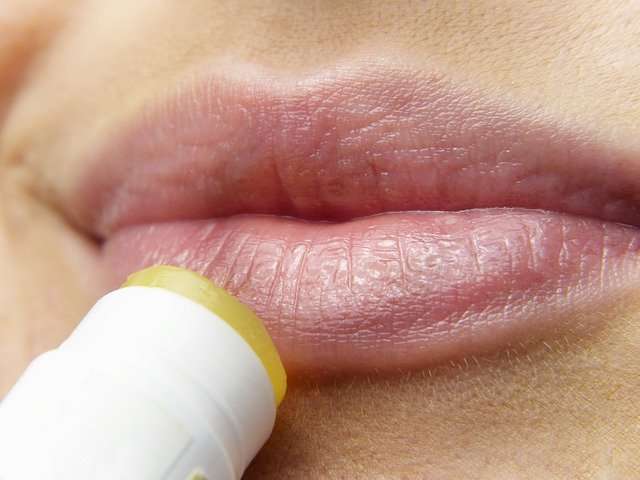 El herpes labial se suele contagiar por el contacto bucal. Imagen ilustrativa Pixabay