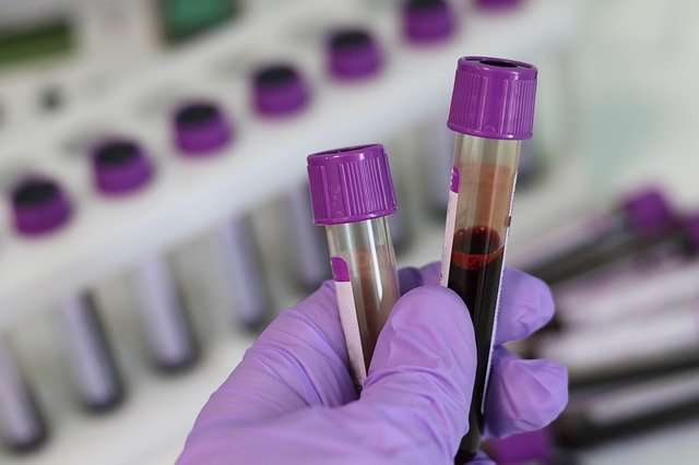 El test detecta los cambios químicos en fragmentos del ADN que se filtran a la sangre a través de los tumores. Foto: Pixabay - Ilustrativa
